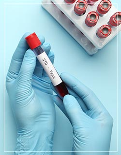 STD Testing Near Me in Miami, FL